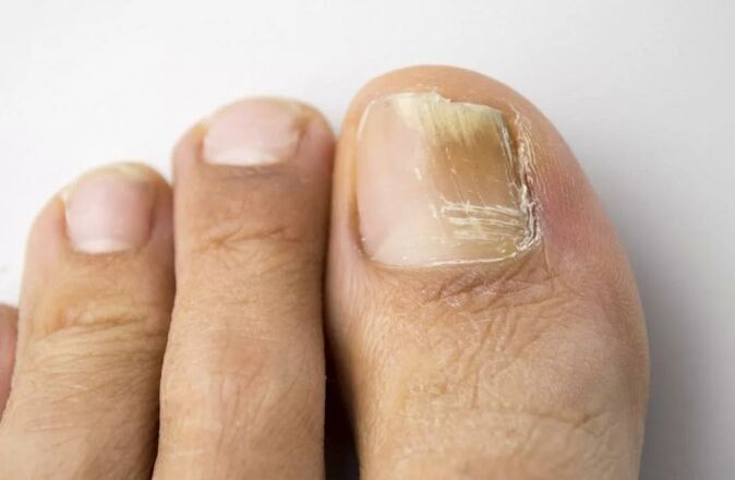 Flottenbehandlung