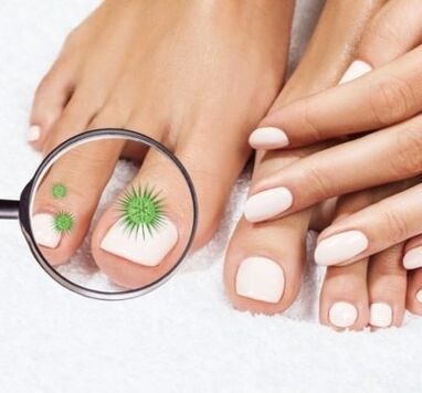 Nagelinfektion durch Vergrößerung