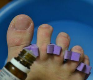 Vorbereitung zur Nagelbehandlung mit antimykotischen Tropfen